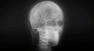 GIF of interior of the skull
